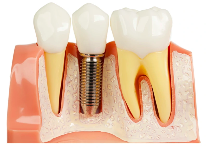 Dental Centrein Al  Ain