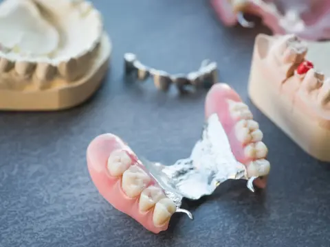Expert Dentures in Al Ain – 1