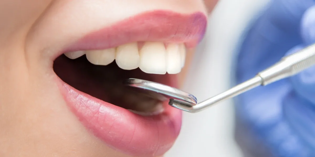 Dental Checkup in Al Ain