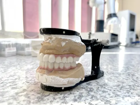 Dental Crowns in Al Ain – 3