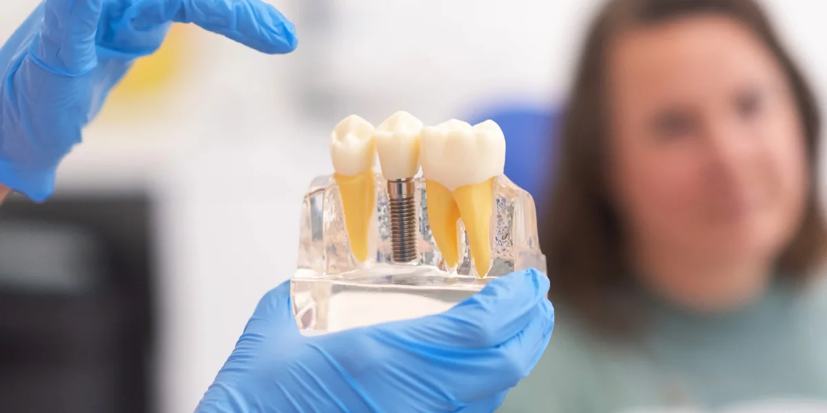 Dental Implants in Al Ain