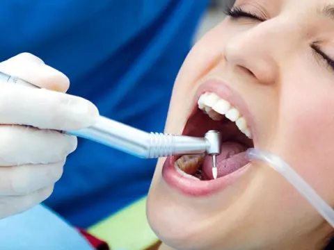Dental Filling in Al Ain – 1