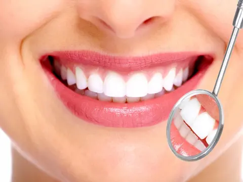 Gum Disease Treatment in Al Ain – 2