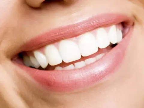 Hollywood Smile in Al Ain – 2