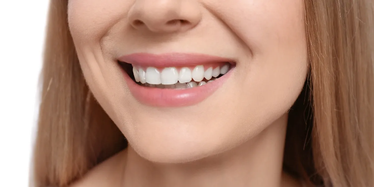 Hollywood Smile in Al Ain
