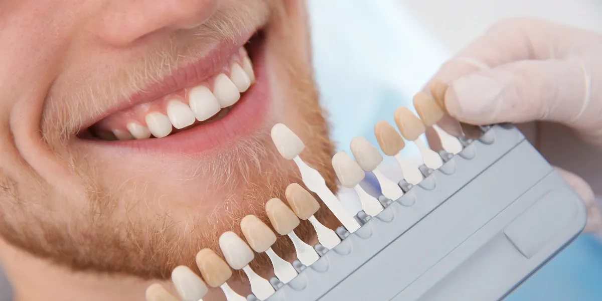 Teeth Whitening in Al Ain