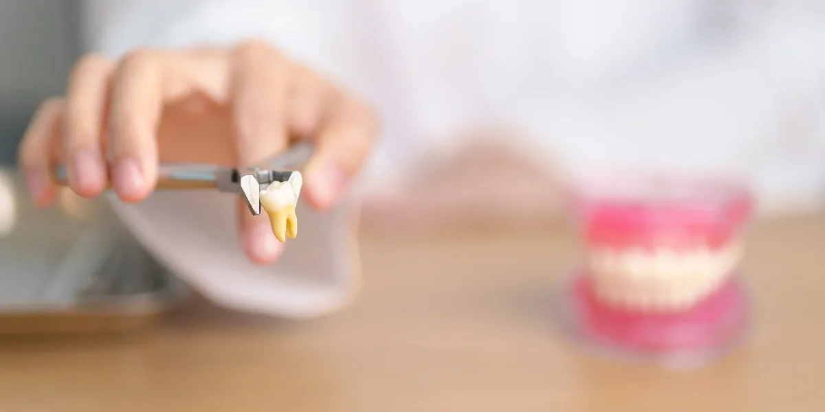 Tooth Extraction in Al Ain
