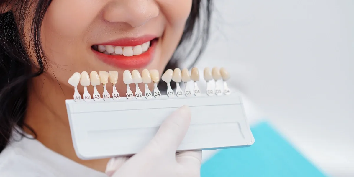 Dental Veneers in Al Ain